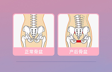 盆底肌修復(fù)儀器怎么樣？哪些人可以使用它呢