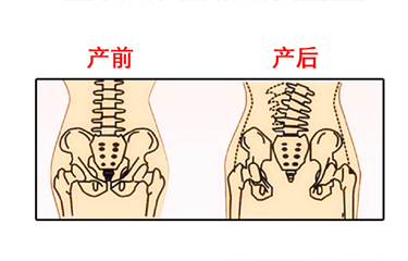 月子期間盆骨儀器修復(fù)時(shí)間有限制嗎？與手法修復(fù)相比哪個(gè)效果好？